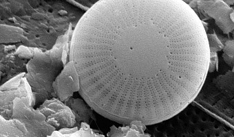 Kieselalge Cyclotella cyclopuncta, elektronenmikroskopische Aufnahme, Vergrößerung 12.200-fach, Dr. R. Kü. 